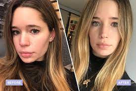 This potent nutrient offers many benefits for the skin, including the potential to: I Got An Antioxidant Filled Iv Drip For Better Skin Glamour