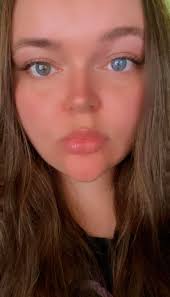 My sectoral heterochromia 💙🤎