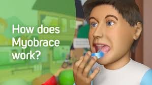 Early orthodontic treatments