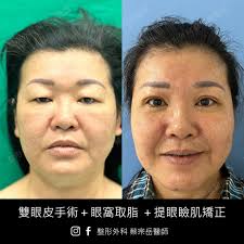 整形外科蔡宗岳醫師- 整形外科蔡宗岳醫師, புதிய படம் சேர்த்துள்ளார்.