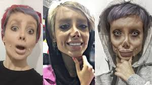 Anna is a communication expert and a life enthusiast. What S Trending On Twitter Plastic Surgery Gone Wrong Teen Transforms Into Angelina Jolie Https T Co Moewsoxod5