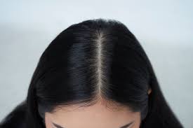 The shea moisture dandruff shampoo treatment is super effective on african american hair. 5 Healthy Signs That Your Anti Dandruff Shampoo Works