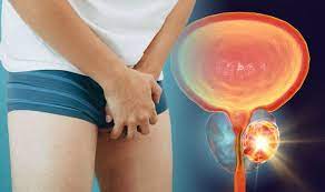 Cancer can also cause the immune system. Prostate Cancer Symptoms The One Sign All Men Should Look Out For Urinary Problems Express Co Uk
