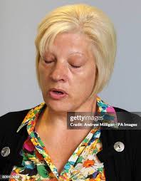 78 Thomas Sharkey Photos & High Res Pictures