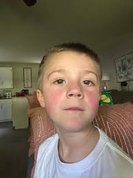 Moms! Jackson started breaking out