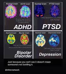 Captain Baez On Twitter: "Fallacies Of Mental Health: #Adhd: It's Just A  Made Up Ailment 2 Give Kids An Excuse 4 Not Paying Attention. #Ptsd: What  Happen 2 U Wasn't Even That