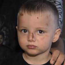 Family says hit-and-run leaves child traumatized