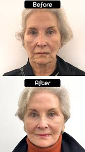 Centre For Facial Cosmetic & Plastic Surgery