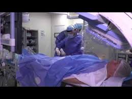 Pratiquement plus utilisé dans cette indication(sauf en cas d'intolérance majeure au clopidogrel ou au prasugrel) du fait de ses. Coronarographie Pose De Stents Youtube