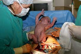 After labor she may feel physically sore, especially if she has stitches, either due to cesarean section or an episiotomy (a deliberate perineal incision) or laceration injury to the perineum. C Section Procedure Recovery Live Science