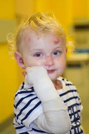 70.000 Euro für Schmetterlingskinder