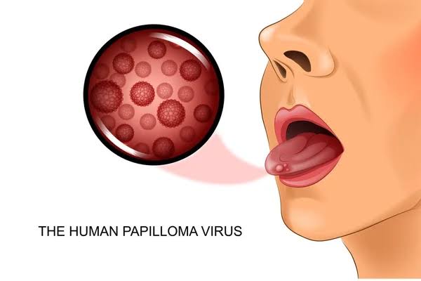 Vectores de Cáncer de lengua, imágenes vectoriales | DepositPhotos