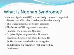 Pin By Nonas Arc On Noonan Syndrome Noonan Syndrome Genetic Disorders Syndrome