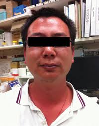 Study: Bites Can Induce Potentially Deadly Systemic Reactions