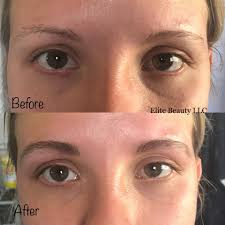 Elite Beauty