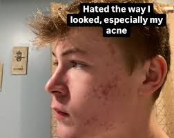 I had many ups and downs in the past 5 years and I still do. But what  matters is that you stay resilient and keep going even if you don't have a