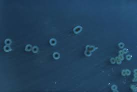 Salmonella infection (salmonellosis) is a common bacterial disease that affects the intestinal tract. Salmonella Enterica Wikipedia