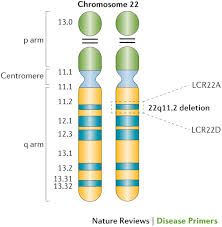 22q11 2 deletion syndrome nature reviews disease primers