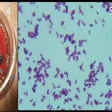 Listeria monocytogenes is common in the intestinal tracts of animals and humans. Gram Positive Coccobacilli Of Listeria Monocytogenes Download Scientific Diagram
