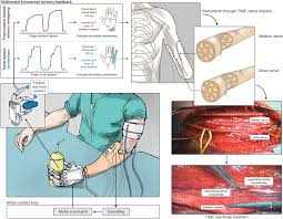 Most of these concerns are over safety regulations. A Closed Loop Hand Prosthesis With Simultaneous Intraneural Tactile And Position Feedback Science Robotics