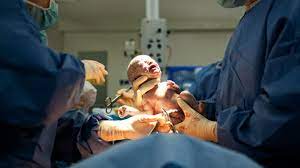 Die wahl der geburtsklinik, wo sie ihr kind zur welt bringen wollen, liegt manche frauen melden sich auch gar nicht an und erscheinen erst kurz vor der geburt wenn die. Geburt So Gefahrlich Ist Sauerstoffmangel Fur Das Baby