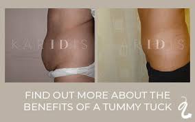 Get the latest and most reliable health and wellness information at healthprep. How To Get Rid Of Stomach Overhang Karidis Clinic