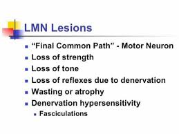 Image result for Neurologic Lesion Localization