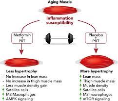 Because Metformin Reduces Inflammation We Hypothesized That It Would Augment The Muscle Response To Progressi Metformin Muscle Hypertrophy Muscle Inflammation