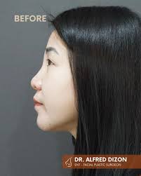 Dr. Alfred Dizon (@drdizonent)