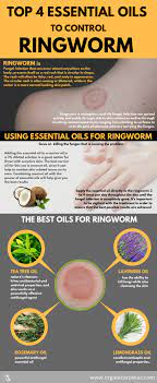 Ringworm often clears with the first treatment a dermatologist prescribes. Does Hand Sanitizer Kill Ringworm On Skin 12 Oz Hand Sanitizer Ringworm Thrives In Warm Moist Areas Of The Body Such As The As Ringworm Is Not Caused By A