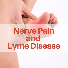 Lyme Sci Nerve Damage Shown In Patients With Chronic Lyme Symptoms