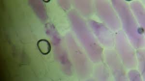 We did not find results for: How Do Hypertonic Solutions Effect Plant Cells Socratic
