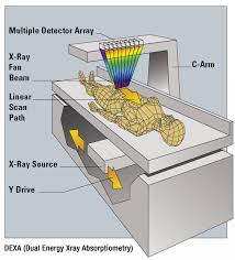 The Pitfalls Of Body Fat Measurement Part 6 Dual Energy X Ray Absorptiometry Dexa Weightology