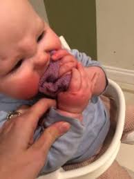 Allergy to wheat and other cereal grains. Is My Baby S Rash A Food Allergy The Baby Child Nutritionist