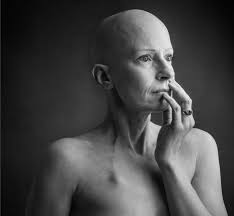 I would say no, because breast cancer is usually painless and a woman doesn't find out until her mamagram or feeling a lump. The Breast Cancer Surgeon Who Got Breast Cancer Bbc News