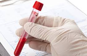 Der schwangerschaftstest für alle, die es schnell und verlässlich wissen möchten ab wann sicher? Depression Diagnostik Per Bluttest