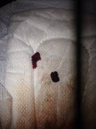 What should my hcg level be at 5 weeks? Miscarriage Or Blood Clot 6 Weeks Pregnant Glow Community