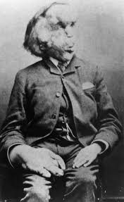 Cavalier Postcards On Twitter Joseph Merrick Human Oddities Sideshow Freaks