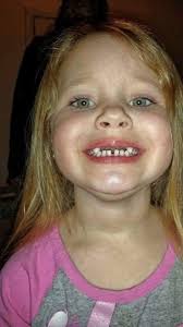 Trying Pro's only and having a great experience