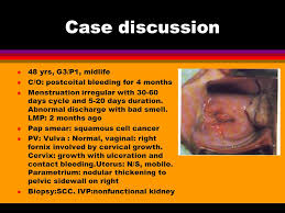 If you have any of these signs, see your doctor. Cervical Cancer Diagnosis Treatment Ppt Video Online Download