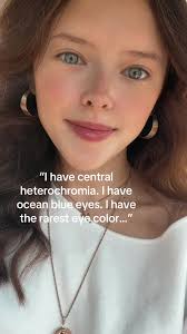 When I was little people called them cat eyes #eyes #rare