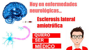 Hacer rm del cerebro y las pruebas de. Esclerosis Lateral Amiotrofica Sintomas Y Tratamientos Youtube