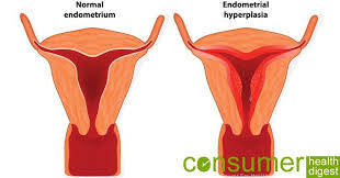 Pin On Women Health Issues