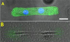 Un fragment din episodul 429/ hingherii! Extracellular Matrix Stiffness Regulates Human Airway Smooth Muscle Contraction By Altering The Cell Cell Coupling Scientific Reports