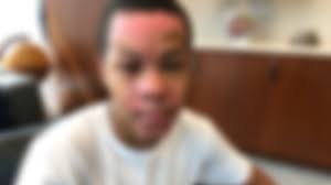 Chemistry teacher 'froze in pure shock' after botched experiment set teen 