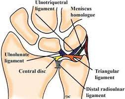 Triangular fibrocartilage complex injury exercises or tfcc injury exercises. Triangular Fibrocartilage Tear Tfc Surgery Orthopedic Wrist Surgeon Houston Tx