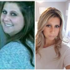 Sharing bariatric recipes and tips