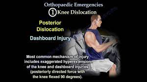 Browse the use examples 'dashboard injury' in the great english corpus. Dashboard Knee Injury Syndrome Personal Injury Lawyer