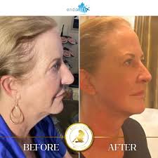 Forever29 MedSpa (@forever29medspa) • Instagram photos and videos