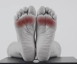 Image result for Metatarsalgia